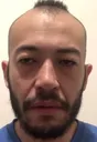 BaldChamp