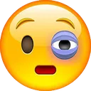 black_eye
