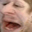 normalHA