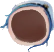 Belomegalul