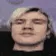 albino_seizure