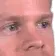 blinkwut