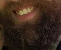 JaleBeard
