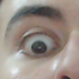 1parca