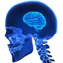 Cerveau1