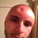 SwollenForehead