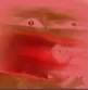 ree