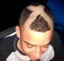 XnegriniiBCG