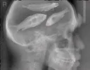 fishbrain