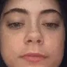 spit