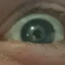 FrycusReye FrycusReye