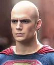 baldsupes