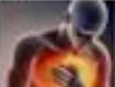heartburn