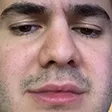 LChamp