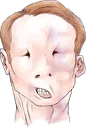 varination2