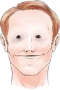 loric