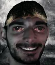 autismo