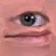 oeil