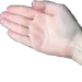 slap