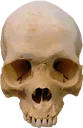 dead1