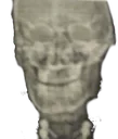 skull11
