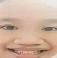 :head: