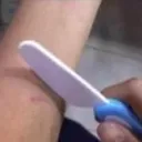 suicide