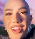 BALD2 BALD2