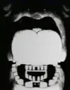 freddy