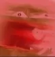 ree