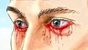 Pain