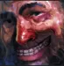 Excrescion