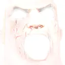 MR_canny_9 MR_canny_9