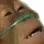 monkeydead