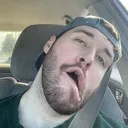 stroke