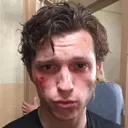 tom1_hurt