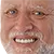 smilethepain