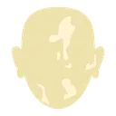 PrettyVitiligo03