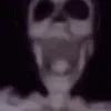 skullcringe