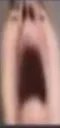 agony