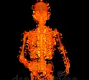 burningskeleton10