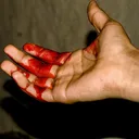 i_cut_my_hand_40
