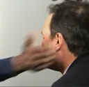 slapped
