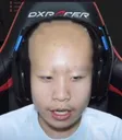 baldman