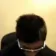 Zyzz