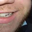 ohneR4