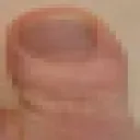 Toe Toe