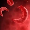 Sickle Cell Community