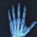 X-ray h's server's icon