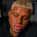 Cheeto Head